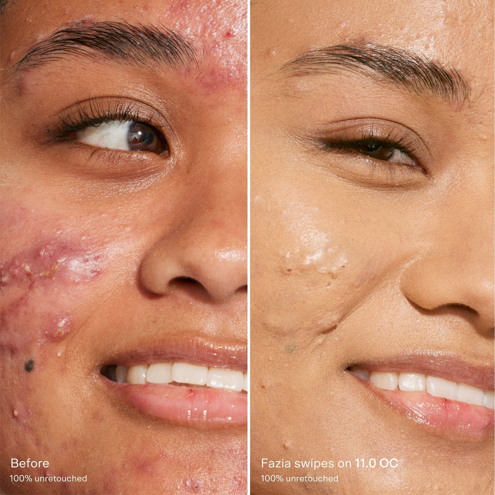 Swipe Serum Concealer®