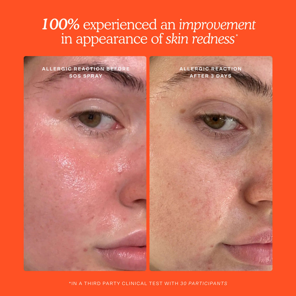 SOS 3-Step Skincare Set